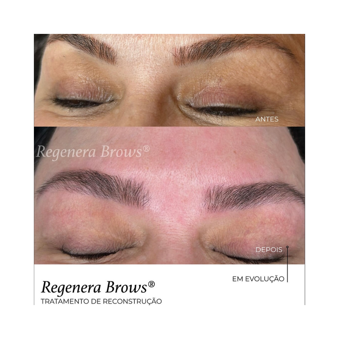 RegeneraBrows - Tratamento de Reconstrução